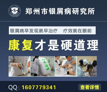 郑州治疗银屑病最权威的医院